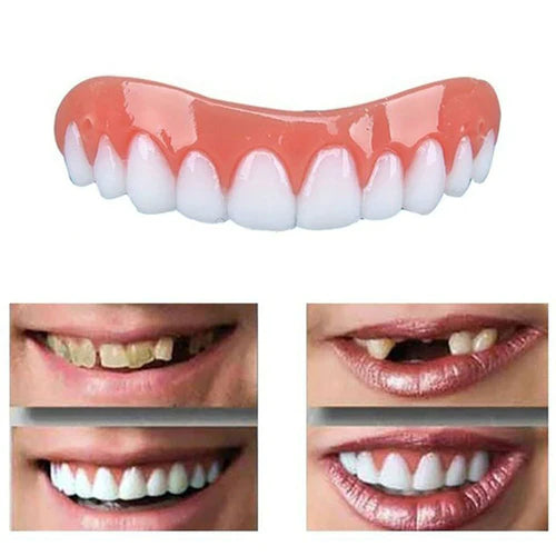 Dentadura Universal NewSmile | Seu Sorriso Vale Ouro (Compre 1 Leve 2)