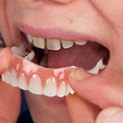 Dentadura Universal NewSmile + Clareador Dental de Fórmula Inovadora V.34 de BRINDE